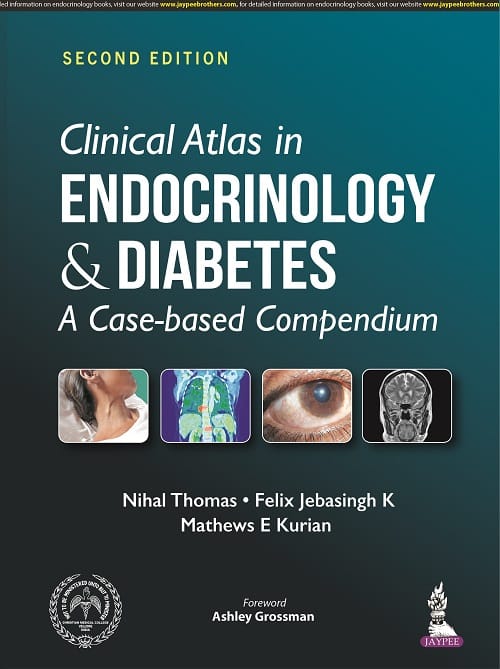 Clinical Atlas in Endocrinology & Diabetes A Case?based Compendium 2nd Edition 2022 By Nihal Thomas
