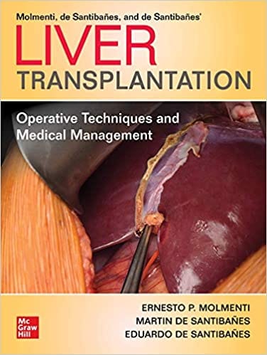 Liver Transplantation: Operative Techniques and Medical Management 2021 By Ernesto P. Molmenti