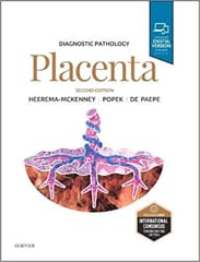 Diagnostic Pathology: Placenta -2E By McKenney