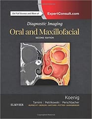 Diagnostic Imaging: Oral And Maxillofacial  - 2E By Koenig