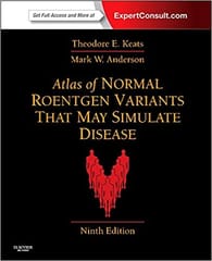 Atlas Of Normal Roentgen Variants 9/E By Keats
