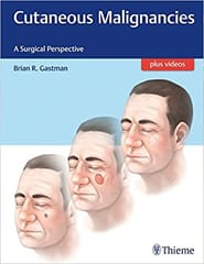 Cutaneous Malignancies A Surgical Perspective 1St Edition By Gastman