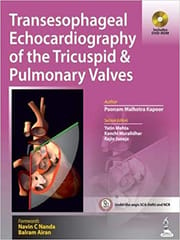 Transesophageal Echocardiography Of The Tricuspid & Pulmonary Valves Includes Dvd-Rom 1st Edition By Kapoor Poonam Malhotra