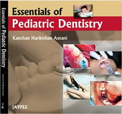 Essentials Of Pediatric Dentistry 1st Edition By Asnani K.H