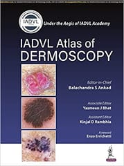 Iadvl Atlas Of Dermoscopy 1st Edition By Balachandra S Ankad