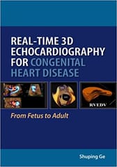 Real-Time 3D Echocardiography For Congenital Heart Disease 1st Edition By Shuping X.Ge