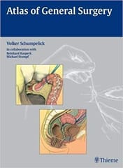 Atlas of General Surgery 2009 By Schumpelick