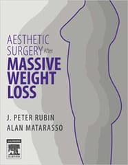 Aesthetic Surgery after Massive Weight Loss 2007 By Rubin Publisher Elsevier
