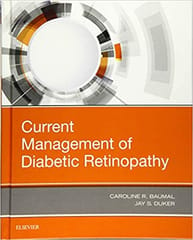 Current Management of Diabetic Retinopathy 2018 By Baumal Publisher Elsevier