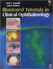 Illustrated Tutorials in Clinical Ophthalmology With CD 2001 By Kanski Publisher Elsevier