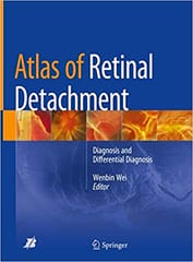 Atlas of Retinal Detachment 2018 By Wei Publisher Springer