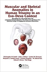 Muscular and Skeletal Anomalies in Human Trisomy in an Evo Devo Context 2015 By Smith Publisher Taylor & Francis