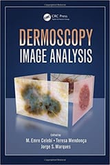 Dermoscopy Image Analysis 2016 By Celebi Publisher Taylor & Francis