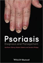 Psoriasis: Diagnosis & Management 2015 By Sterry Publisher Wiley