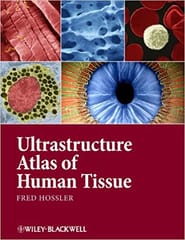 Ultrastructure Atlas of Human Tissues 2014 By Hossler Publisher Wiley