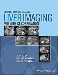 Current Clinical Imaging Liver Imaging MRI With CT Correlation 2014 By Altun Publisher Wiley