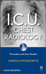 ICU Chest Radiology: Principles & Case Studies With CD 2010 By Moskowitz Publisher Wiley