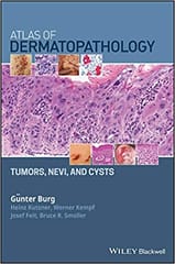 Atlas of Dermatopathology: Tumors Nevi and Cysts 2019 By Burg Publisher Wiley