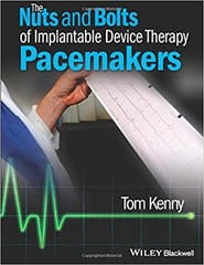 The Nuts and Bolts of Implantable Device Therapy Pacemakers 2015 By Kenny Publisher Wiley