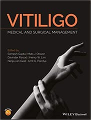 Vitiligo: Medical and Surgical Management 2018 By Gupta Publisher Wiley