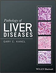 Pathology of Liver Diseases 2017 By Kanel Publisher Wiley