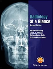 Radiology at a Glance 2nd Edition 2018 By Chouwdhury Publisher Wiley