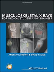 Musculoskeletal X Rays For Medical Students and Trainees 2017 By Brown A K Publisher Wiley