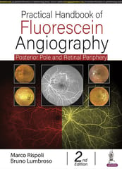 Practical Handbook of Fluorescein Angiography 2nd edition 2022 By Marco Rispoli