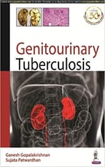 Genitourinary Tuberculosis 1st Edition 2020 By Ganesh Gopalakrishnan