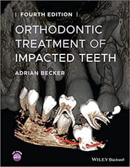 Orthodontic Treatment Of Impacted Teeth 4th Edition 2022 By Becker A