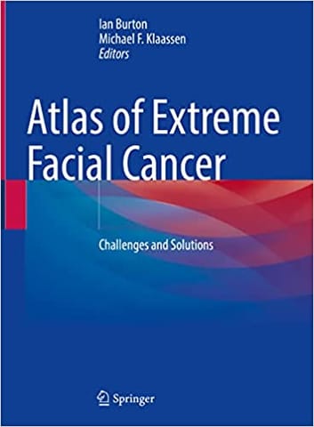 Atlas Of Extreme Facial Cancer Challenges And Solutions 2022 By Burton I
