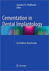Cementation In Dental Implantology An Evidence Based Guide 2015 By Wadhwani C P K