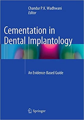 Cementation In Dental Implantology An Evidence Based Guide 2015 By Wadhwani C P K