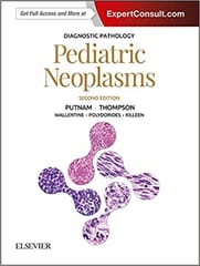 Diagnostics Pathology Pediatric Neoplasms 2nd Edition 2018 By Putnam A R