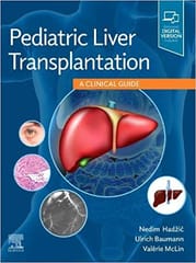 Pediatric Liver Transplantation A Clinical Guide 2021 By Hadzic N