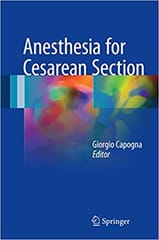 Anesthesia For Cesarean Section 2017 By Capogna G