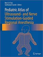 Pediatric Atlas Of Ultrasound And Nerve Stimulation Guided Regional Anesthesia 2016 By Tsui B C H