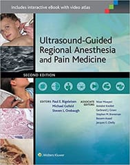 Ultrasoundguided Regional Anesthesia And Pain Medicine 2nd Edition 2015 By Bigeleisen P E