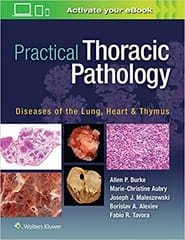 Practical Thoracic Pathology Diseases Of The Lung Heart And Thymus 2017 By Burke A P