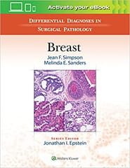 Differential Diagnoses In Surgical Pathology Breast 2017 By Simpson J F