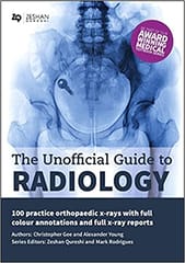 The Unofficial Guide To Radiology 100 Practice Orthopaedic X Rays With Full Colour Annotations And Full X Ray Reports 2019 By Rodrigues M