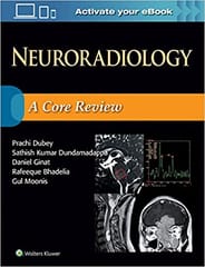 Neuroradiology A Core Review 2018 By Dubey P
