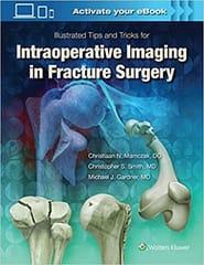 Illustrated Tips And Tricks For Intraoperative Imaging In Fracture Surgery 2018 By Mamczak C N