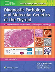 Diagnostic Pathology And Molecular Genetics Of The Thyroid A Comprehensive Guide For Practicing Thyroid Pathology 3rd Edition 2020 By Nikiforov Y E