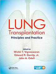 Lung Transplantation Principles And Practice 2020 By Vigneswaran W T