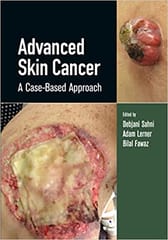 Advanced Skin Cancer A Case Based Approach 2022 By Sahni D