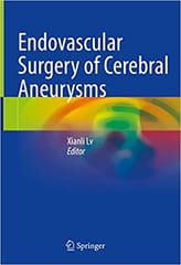 Endovascular Surgery Of Cerebral Aneurysms 2022 By Lv X