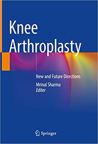 Knee Arthroplasty New And Future Directions 2022 By Sharma M