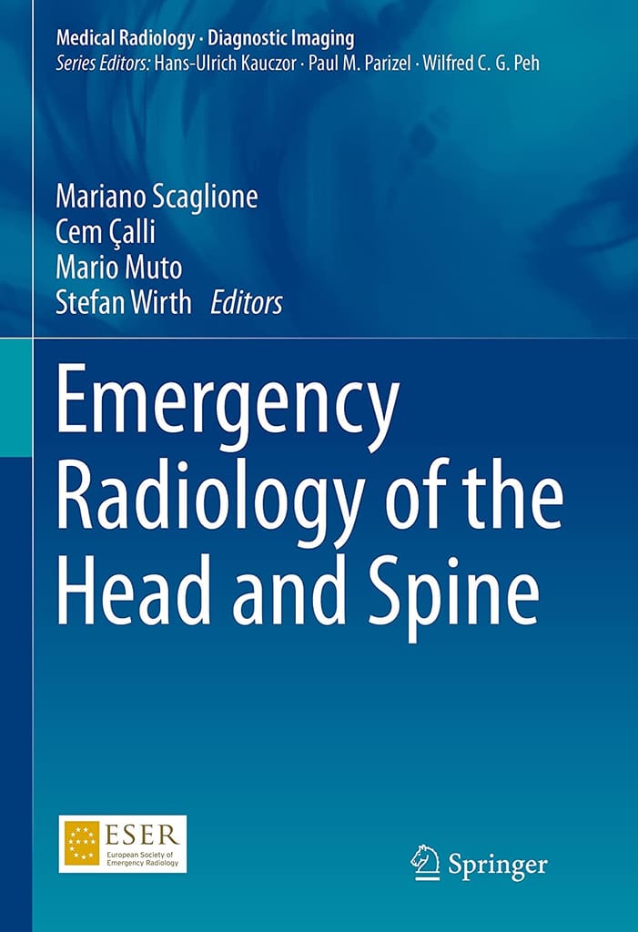 Emergency Radiology Of The Head And Spine 2022 By Scaglione M