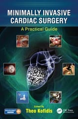 Minimally Invasive Cardiac Surgery A Practical Guide 2021 By Kofidis T